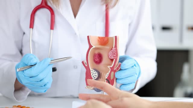 Cómo prevenir el cáncer de colon